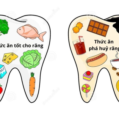 Bí Quyết Chăm Sóc Răng Miệng Đúng Cách