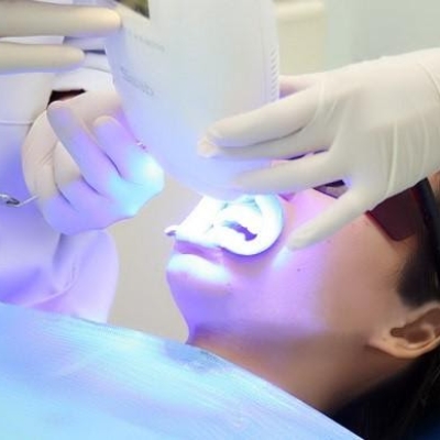 Tẩy trắng răng tại phòng quận 8
