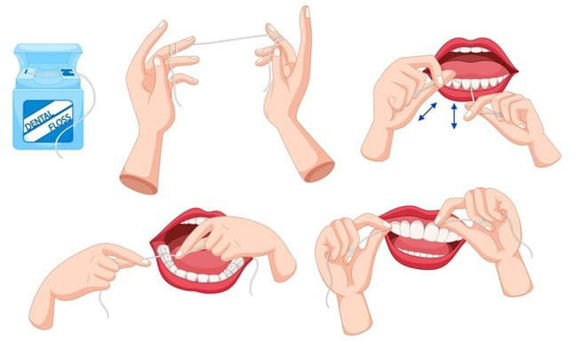 Sử dụng chỉ nha khoa là Bí Quyết Chăm Sóc Răng Miệng Đúng Cách