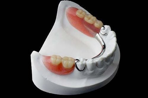 quy trình làm hàm khung kim loại quận 8 chuẩn y khoa