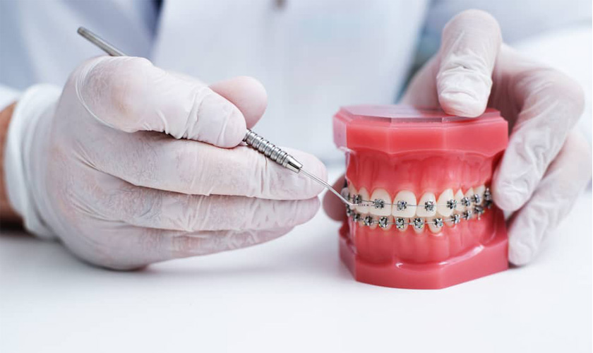Các công nghệ niềng răng thẩm mỹ quận 8 mới nhất