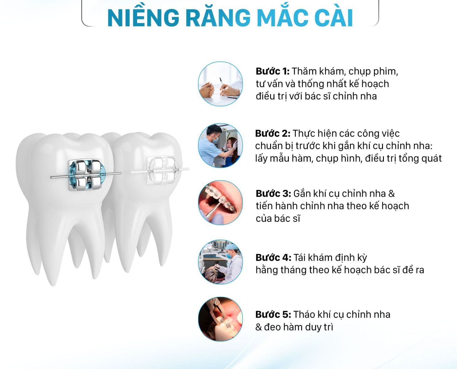 quy trình niềng răng chuyên nghiệp tại quận 8