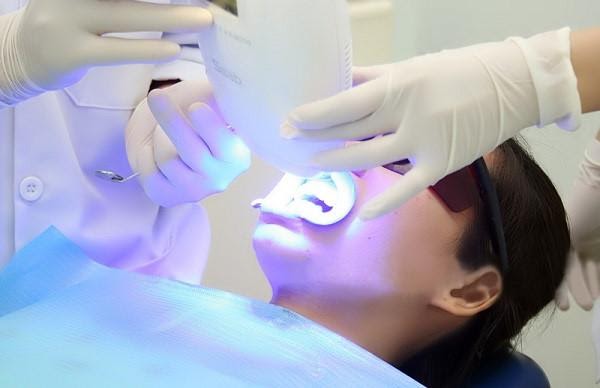 tẩy trắng răng tại nhà quận 8 hiệu quả tự nhiên