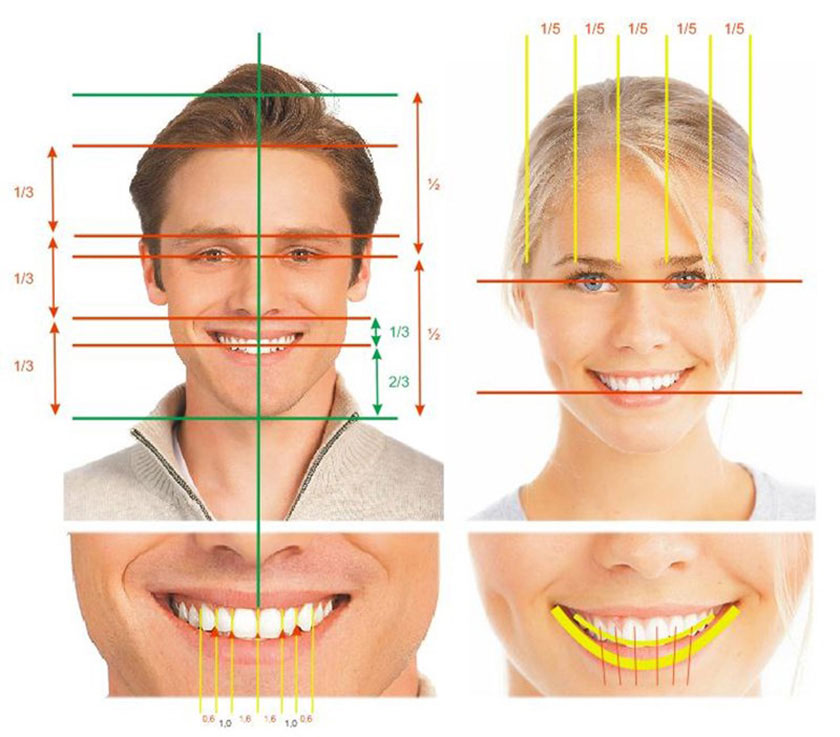 quy trình dán sứ veneer chuyên nghiệp